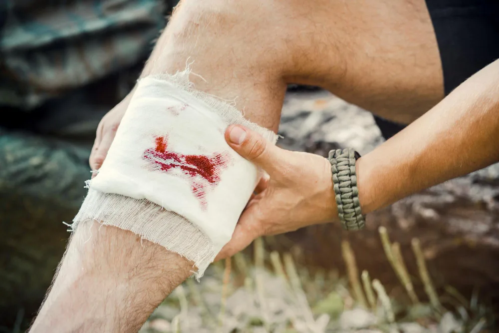 Heridas complejas en Puebla